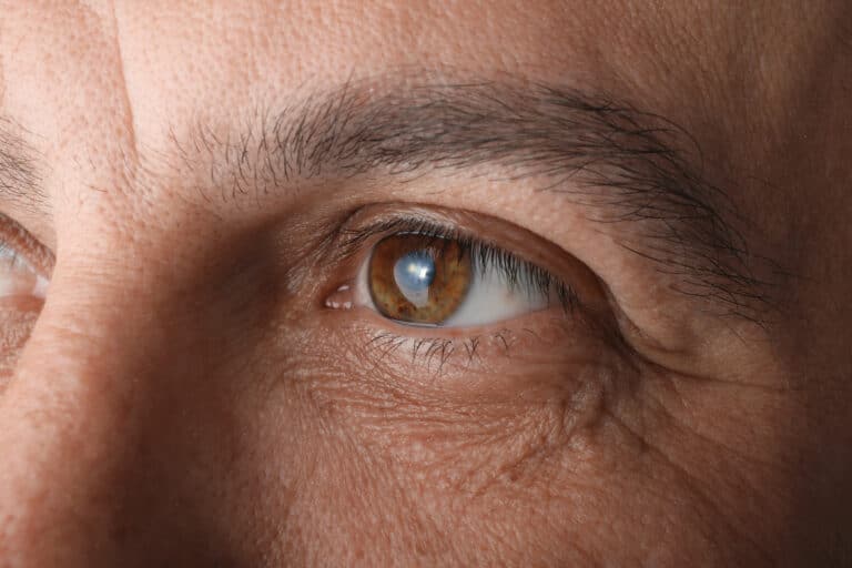How Are Cataracts Removed?